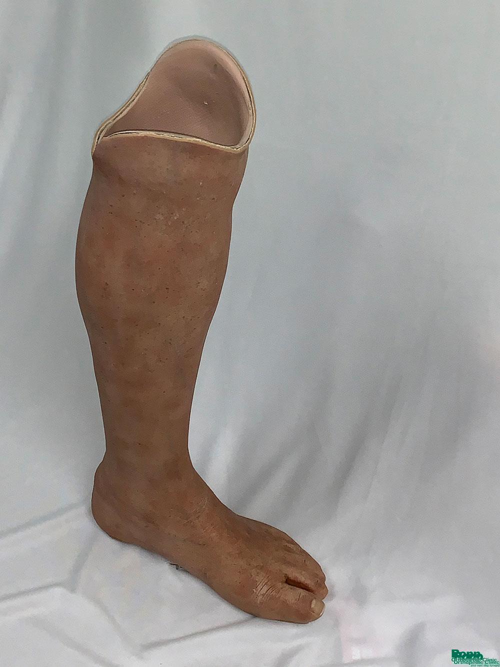 Custom silicone skin for a prosthetic.